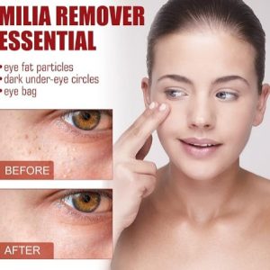 Smooth Milia Remover Serum